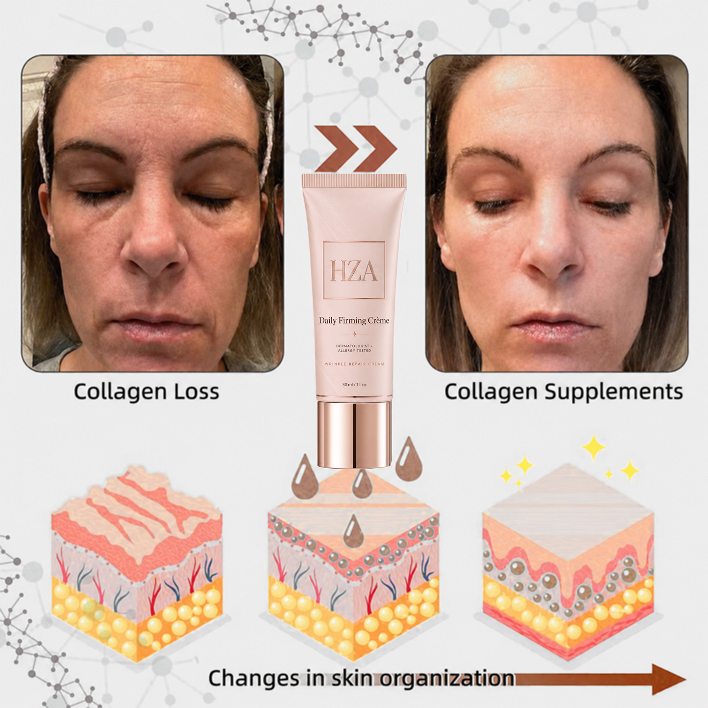 Last Day Discount: 87% OFF 🌸 Second Gen Instant Wrinkle Eraser 🌟